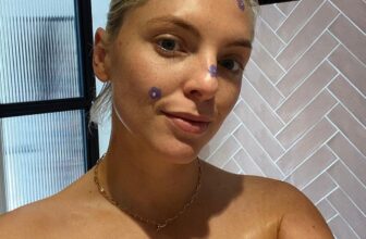 Blemish Management — Estée Lalonde